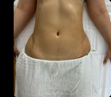 Después — Drenaje